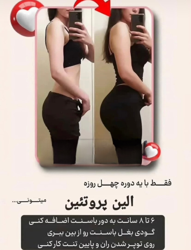 دوره حجم دهی باسن - لیفت و فرم دهی باسن